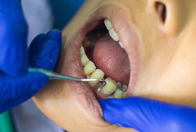 Dental Check-up & Diagnostic